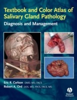 EBOOK Textbook and Color Atlas of Salivary Gland Pathology