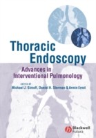 EBOOK Thoracic Endoscopy