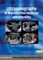 EBOOK Ultrasonography in Reproductive Medicine and Infertility