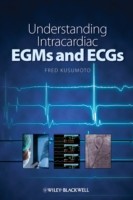 EBOOK Understanding Intracardiac EGMs and ECGs