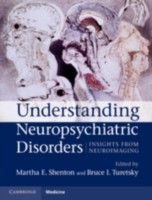 EBOOK Understanding Neuropsychiatric Disorders