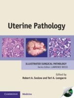 EBOOK Uterine Pathology