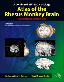 A Combined MRI and Histology Atlas of the Rhesus Monkey Brain in Stereotaxic Coordinates