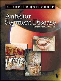 Anterior Segment Disease
