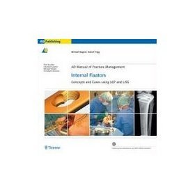 AO Manual of Fracture Management