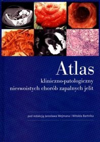 Atlas kliniczno-patologiczny nieswoistych chorób zapalnych jelit