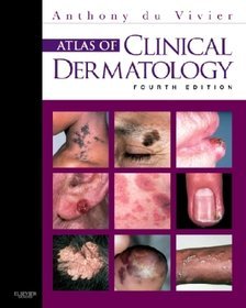 Atlas of Clinical Dermatology