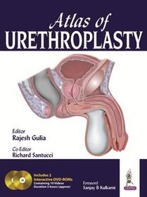 Atlas of Urethroplasty