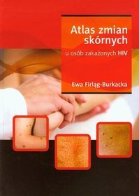 Atlas zmian skórnych u osób zakażonych HIV