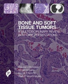 Bone and Soft Tissue Tumours