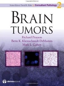 Brain Tumors