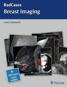 Breast Imaging