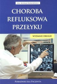 Choroba refluksowa przełyku. Poradnik dla pacjenta
