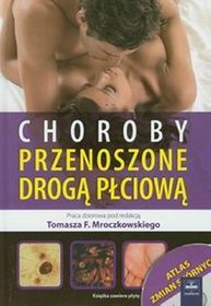 Choroby przenoszone drogą płciową z płytą CD