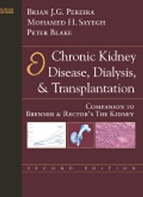 Chronic Kidney Disease Dialysis  Transplantation
