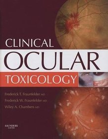 Clinical Ocular Toxicology