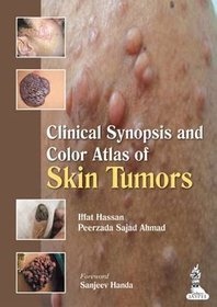 Clinical Synopsis and Color Atlas of Skin Tumors