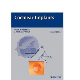 Cochlear Implantis