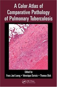 Color Atlas of Comparative Pathology of Pulmonary Tuberculos