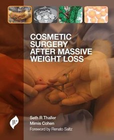Cosmetic Surgery After Massive Weight Loss