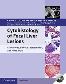 Cytohistology of Focal Liver Lesions