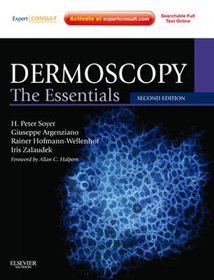 Dermoscopy