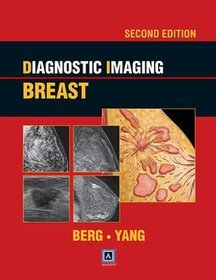 Diagnostic Imaging: Breast