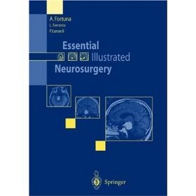 Essential Illustrated Neurosurgery