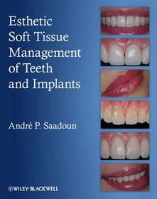 Esthetic Soft Tissue Management of Teeth and Implants