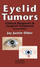 Eyelid Tumours