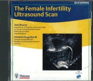 Female Infertility Ultrasound Scan