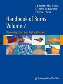 Handbook of Burns v 1