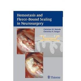 Hemostasis  Fleece-bound Sealing in Neurosurgery