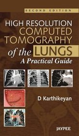 High Resolution Computed Tomography of the Lungs: A Practical Guide