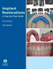 Implant Restoration Solutions