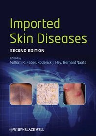 Imported Skin Diseases