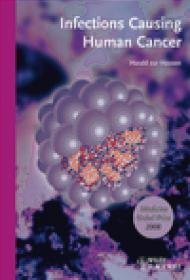 Infections Causing Human Cancer