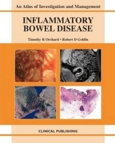 Inflammatory Bowel Disease