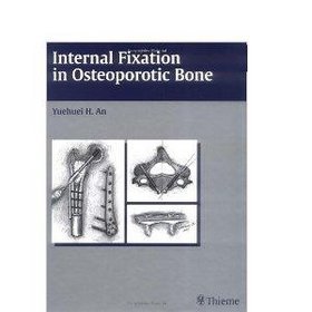 Internal Fixation in Osteoporotic Bone