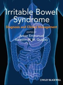 Irritable Bowel Syndrome: Diagnosis and Clinical Management