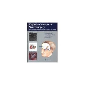 Keyhole Concept in Neurosurgery