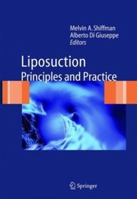 Liposuction Principles  Practice