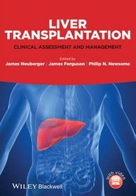 Liver Transplantation