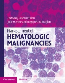 Management of Hematologic Malignancies