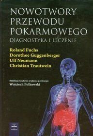 Nowotwory przewodu pokarmowego