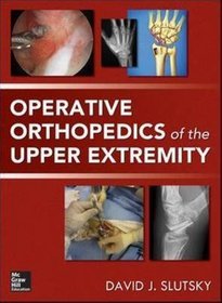 Operative Orthopedics of the Upper Extremity