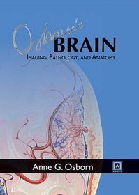 Osborn's Brain: Imaging, Pathology, and Anatomy