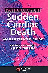 Pathology of Sudden Cardiac Death