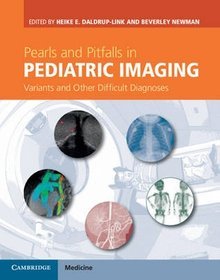 Pearls and Pitfalls in Pediatric Imaging