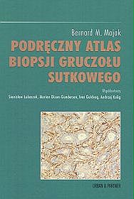 Podręczny atlas biopsji gruczołu sutkowego
